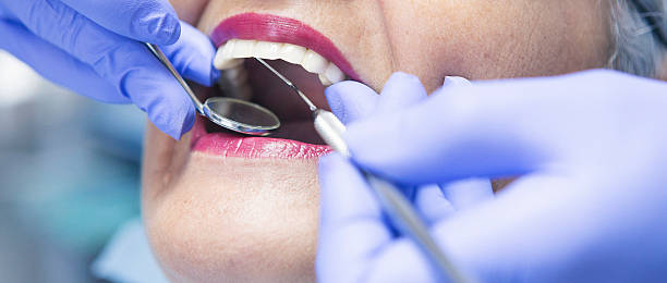 Best Knocked-Out Tooth (Avulsed Tooth) Treatment in Clisle, AR